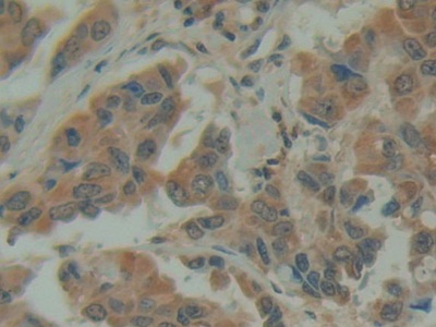 Polyclonal Antibody to Family With Sequence Similarity 3, Member D (FAM3D)