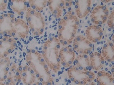 Polyclonal Antibody to Pentraxin 3, Long (PTX3)