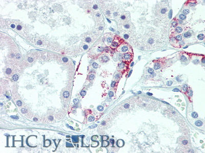 Polyclonal Antibody to Transmembrane Protein 27 (TMEM27)