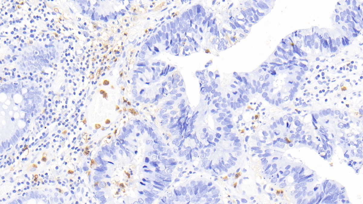 Polyclonal Antibody to Calprotectin (CALPRO)