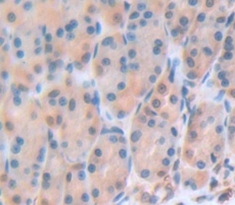 Polyclonal Antibody to Gastrokine 3 (GKN3)