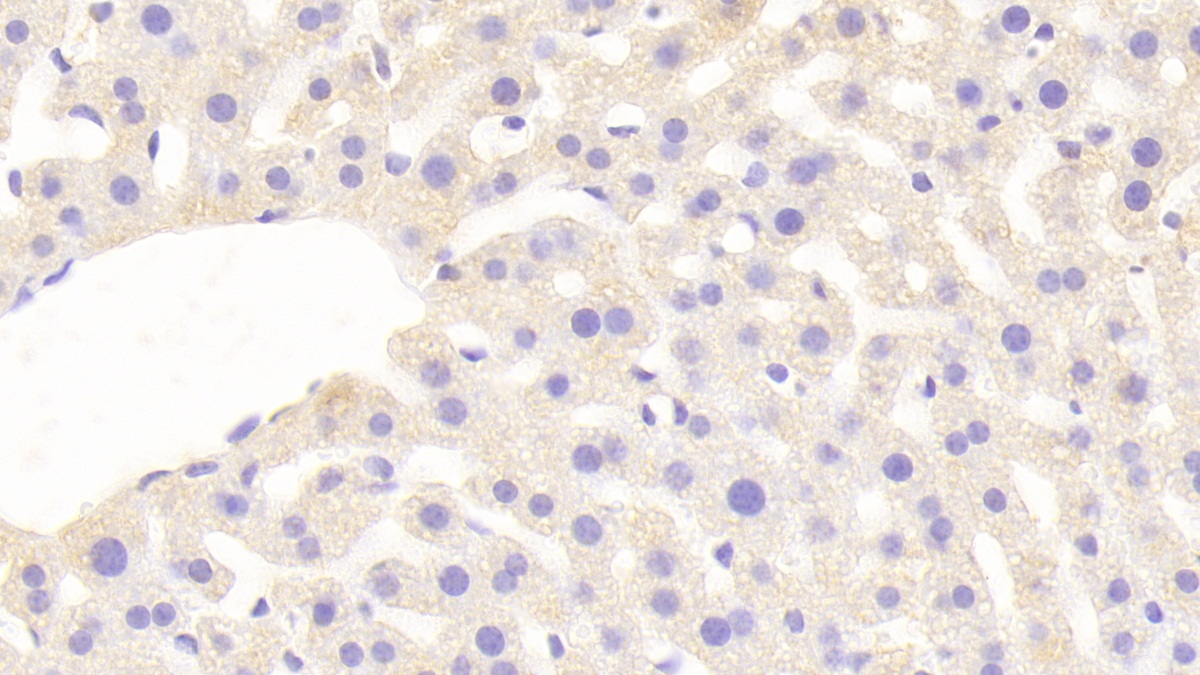 Polyclonal Antibody to Sprouty Homolog 3 (SPRY3)