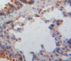 Polyclonal Antibody to Notch Homolog 3 (NOTCH3)