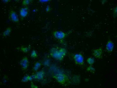 Polyclonal Antibody to Alpha-2-Glycoprotein 1, Zinc Binding (aZGP1)