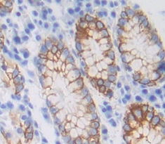 Polyclonal Antibody to Beta-1,3-Galactosyltransferase 5 (b3GALT5)