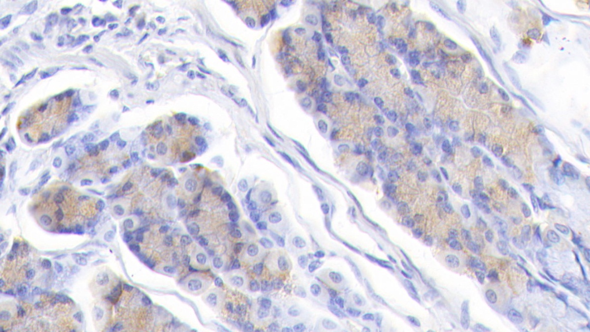 Polyclonal Antibody to B-Cell CLL/Lymphoma 2 Like Protein 2 (Bcl2L2)