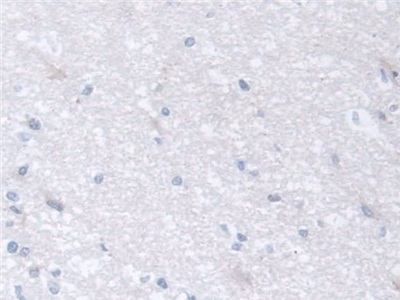 Polyclonal Antibody to Chaperonin Containing TCP1, Subunit 2 (CCT2)