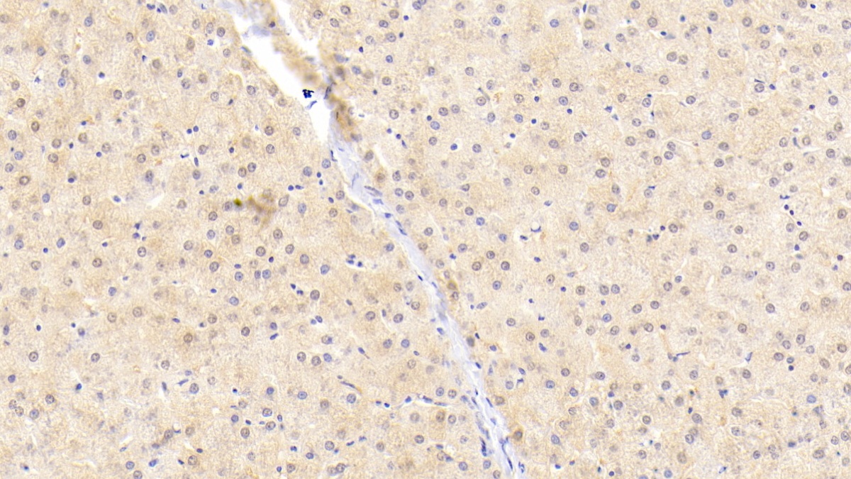 Polyclonal Antibody to Cell Death Inducing DFFA Like Effector A (CIDEA)