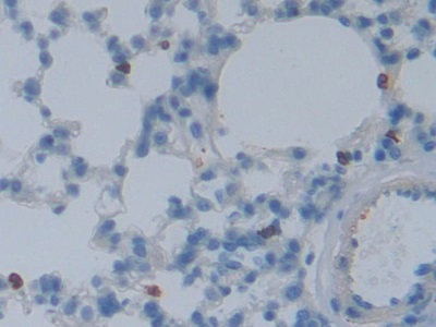 Polyclonal Antibody to DNA Fragmentation Factor Subunit Alpha (DFFa)