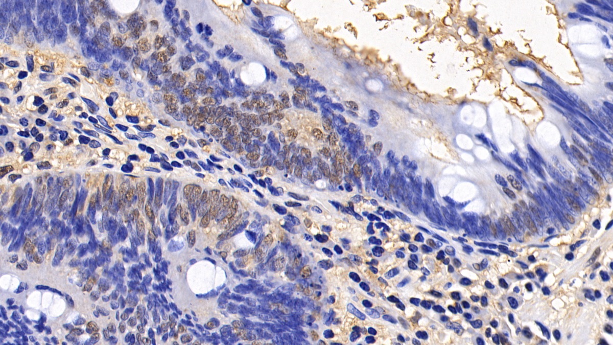 Polyclonal Antibody to Eukaryotic Translation Initiation Factor 4E Binding Protein 1 (EIF4EBP1)