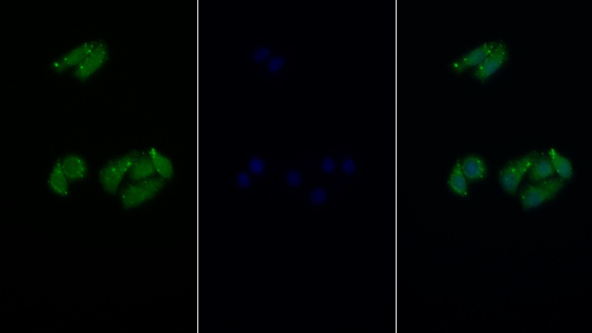 Polyclonal Antibody to Eukaryotic Translation Initiation Factor 4E Binding Protein 1 (EIF4EBP1)