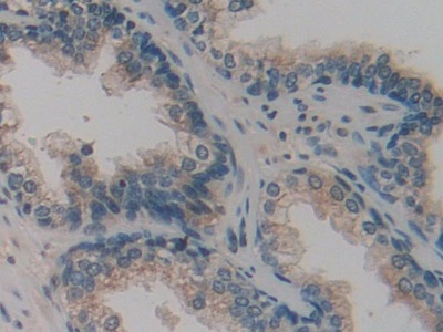 Polyclonal Antibody to Family With Sequence Similarity 3, Member C (FAM3C)