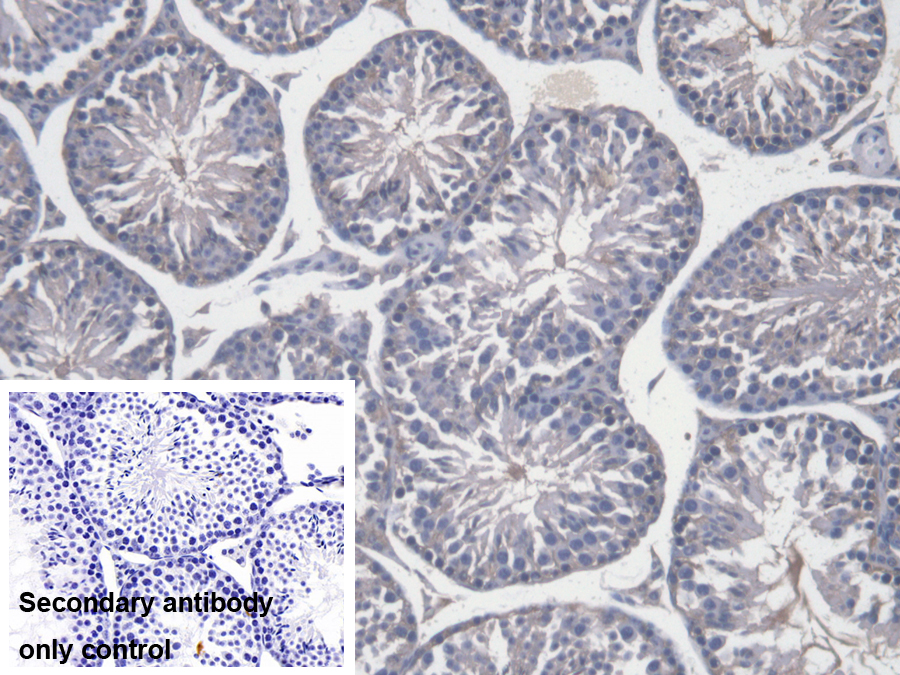 Polyclonal Antibody to FK506 Binding Protein Like Protein (FKBPL)