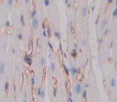 Polyclonal Antibody to Phosphoinositide Kinase, FYVE Finger Containing (PIKFYVE)