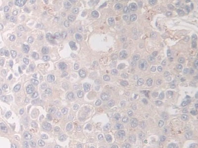 Polyclonal Antibody to Hermansky Pudlak Syndrome Protein 4 (HPS4)