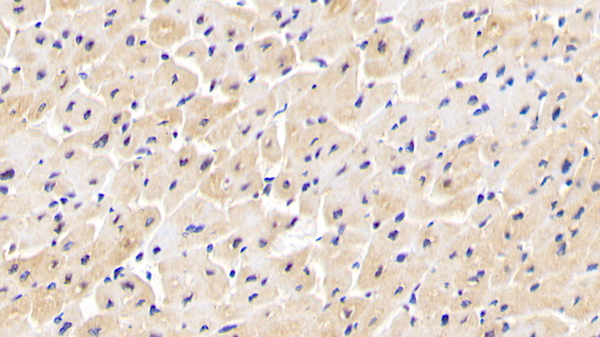 Polyclonal Antibody to Inositol Polyphosphate-4-Phosphatase Type I 107kDa (INPP4A)