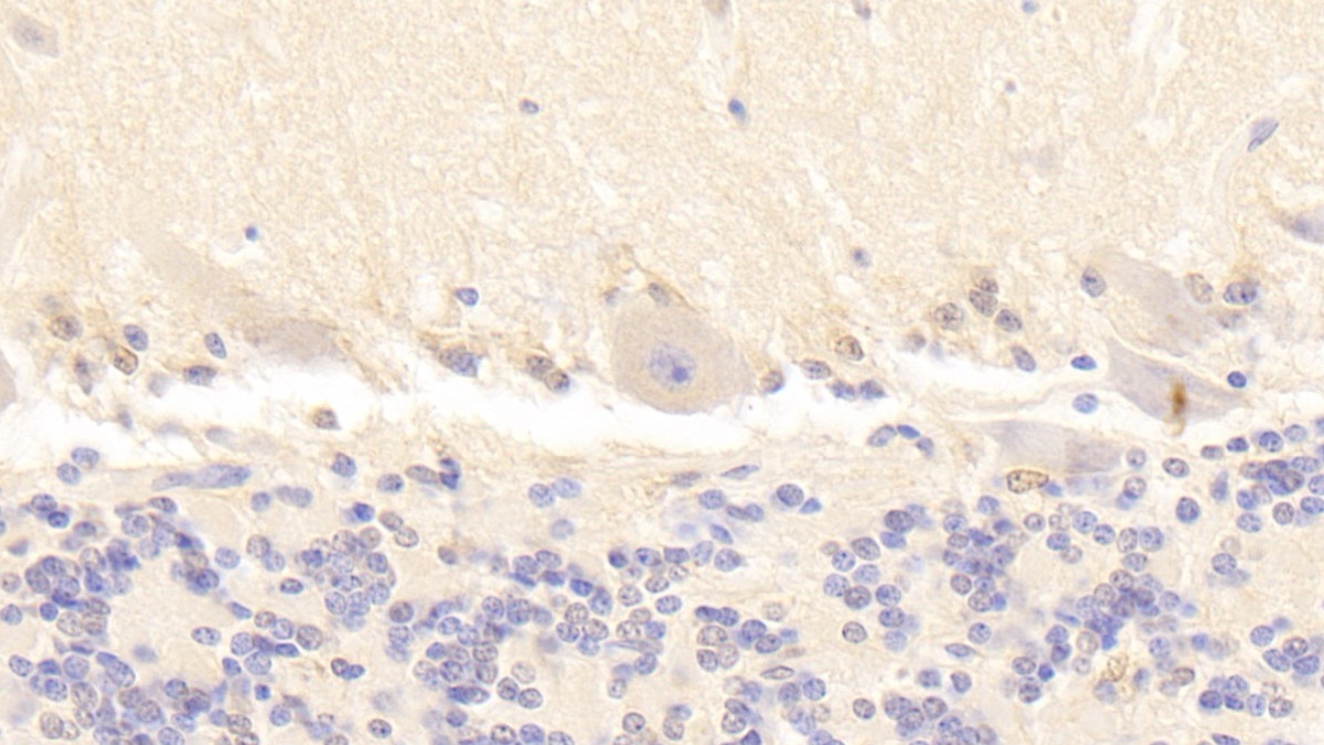 Polyclonal Antibody to Leucine Rich Repeats And Immunoglobulin Like Domains Protein 1 (LRIG1)