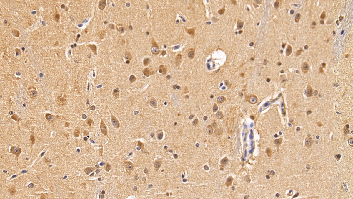 Polyclonal Antibody to Microtubule Associated Protein 1 Light Chain 3 Alpha (MAP1LC3a)