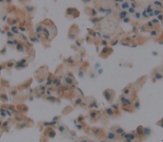 Polyclonal Antibody to Mindbomb Homolog 1 (MIB1)