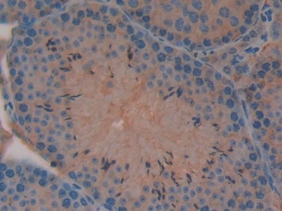 Polyclonal Antibody to Mindbomb Homolog 2 (MIB2)