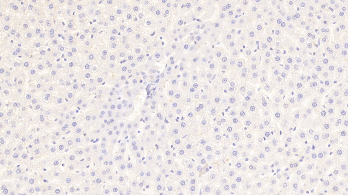 Polyclonal Antibody to Mindbomb Homolog 2 (MIB2)