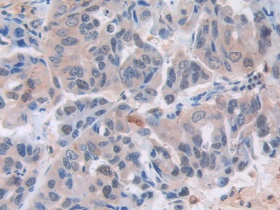 Polyclonal Antibody to Myxovirus Resistance 1 (MX1)