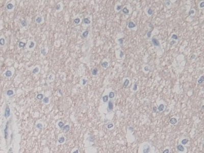 Polyclonal Antibody to Myxovirus Resistance 2 (MX2)