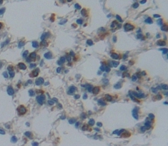 Polyclonal Antibody to Upregulator Of Cell Proliferation (URGCP)