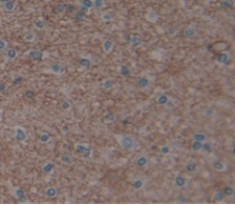 Polyclonal Antibody to Uveal Autoantigen With Coiled Coil Domains And Ankyrin Repeats (UACA)