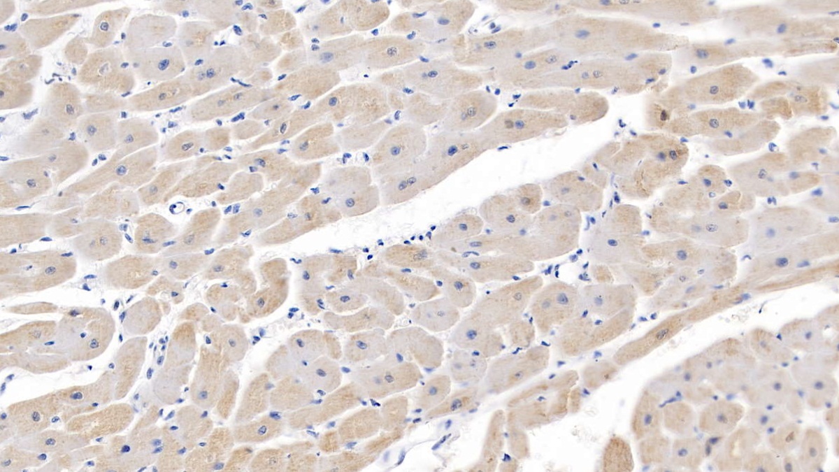 Polyclonal Antibody to Semaphorin 5B (SEMA5B)