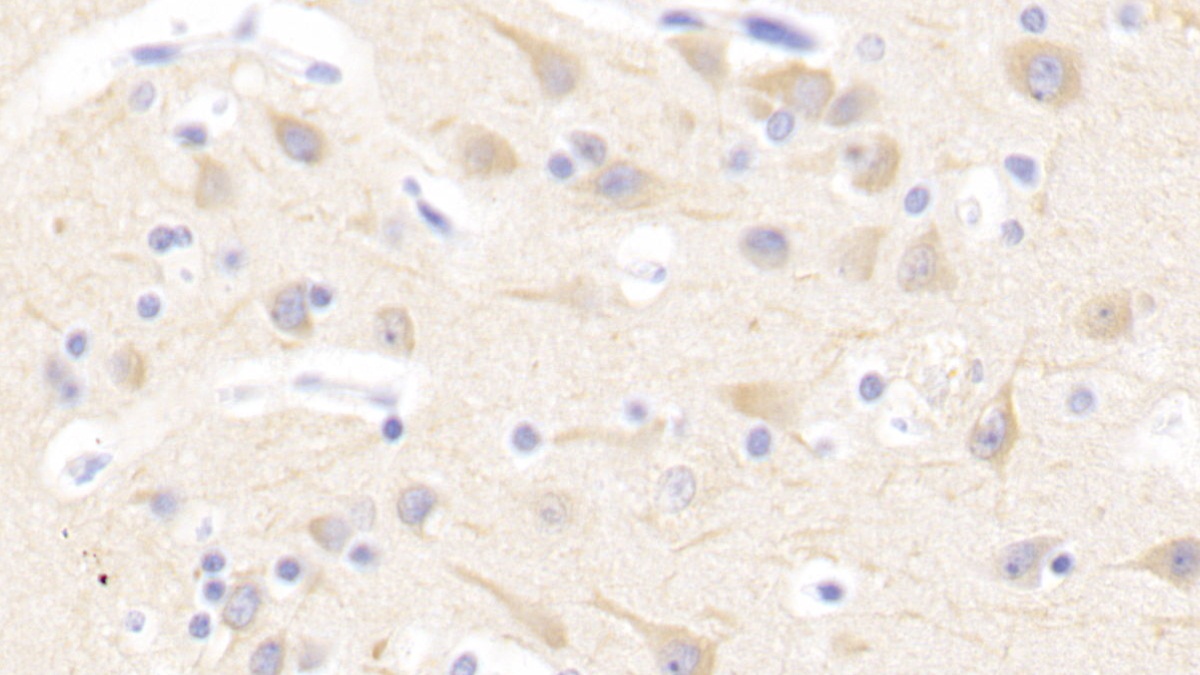 Polyclonal Antibody to Nuclear Factor, Erythroid Derived 2 Like Protein 2 (NFE2L2)