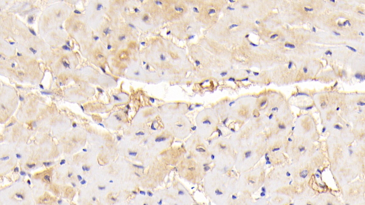 Polyclonal Antibody to NUAK Family SNF1 Like Kinase 1 (NUAK1)