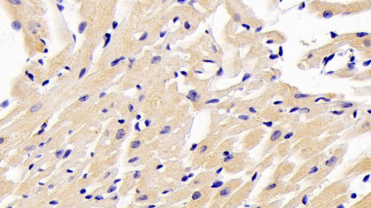 Polyclonal Antibody to NUAK Family SNF1 Like Kinase 1 (NUAK1)