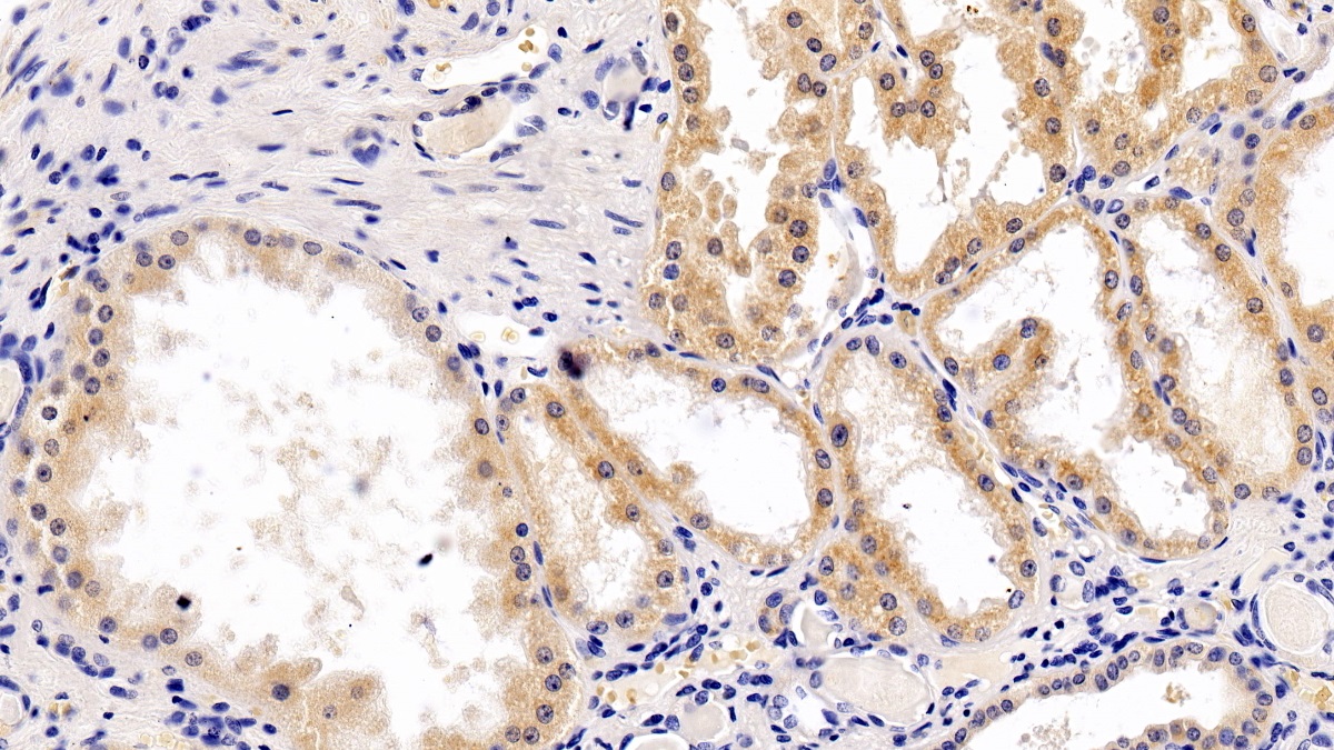 Polyclonal Antibody to Ribosomal Protein S6 Kinase Beta 1 (RPS6Kb1)