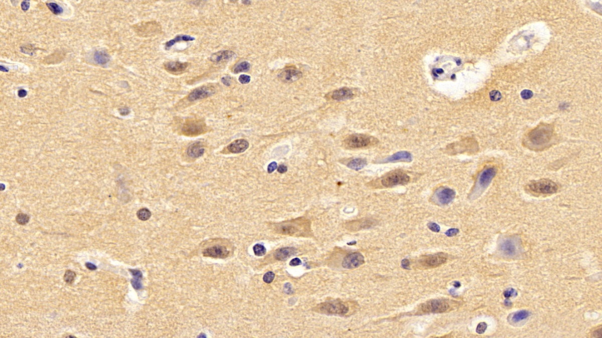 Polyclonal Antibody to Protein L-Isoaspartate-O-Methyltransferase (PCMT1)