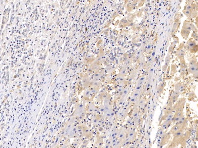 Polyclonal Antibody to Prolactin Induced Protein (PIP)