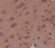 Polyclonal Antibody to Prolactin Induced Protein (PIP)