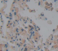 Polyclonal Antibody to Peroxidasin Homolog (PXDN)