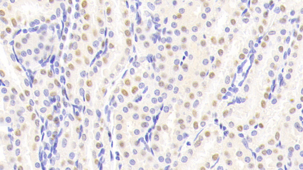 Polyclonal Antibody to Ribosomal Protein S6 Kinase Beta 2 (RPS6Kb2)