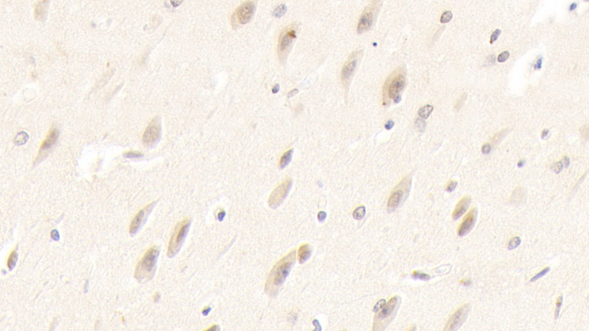 Polyclonal Antibody to RCC1 And BTB Domain Containing Protein 2 (RCBTB2)