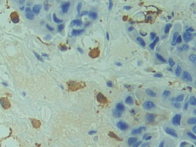 Polyclonal Antibody to Related To Receptor Tyrosine Kinase (RYK)