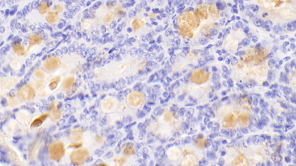 Polyclonal Antibody to Resistin Like Beta (RETNLb)