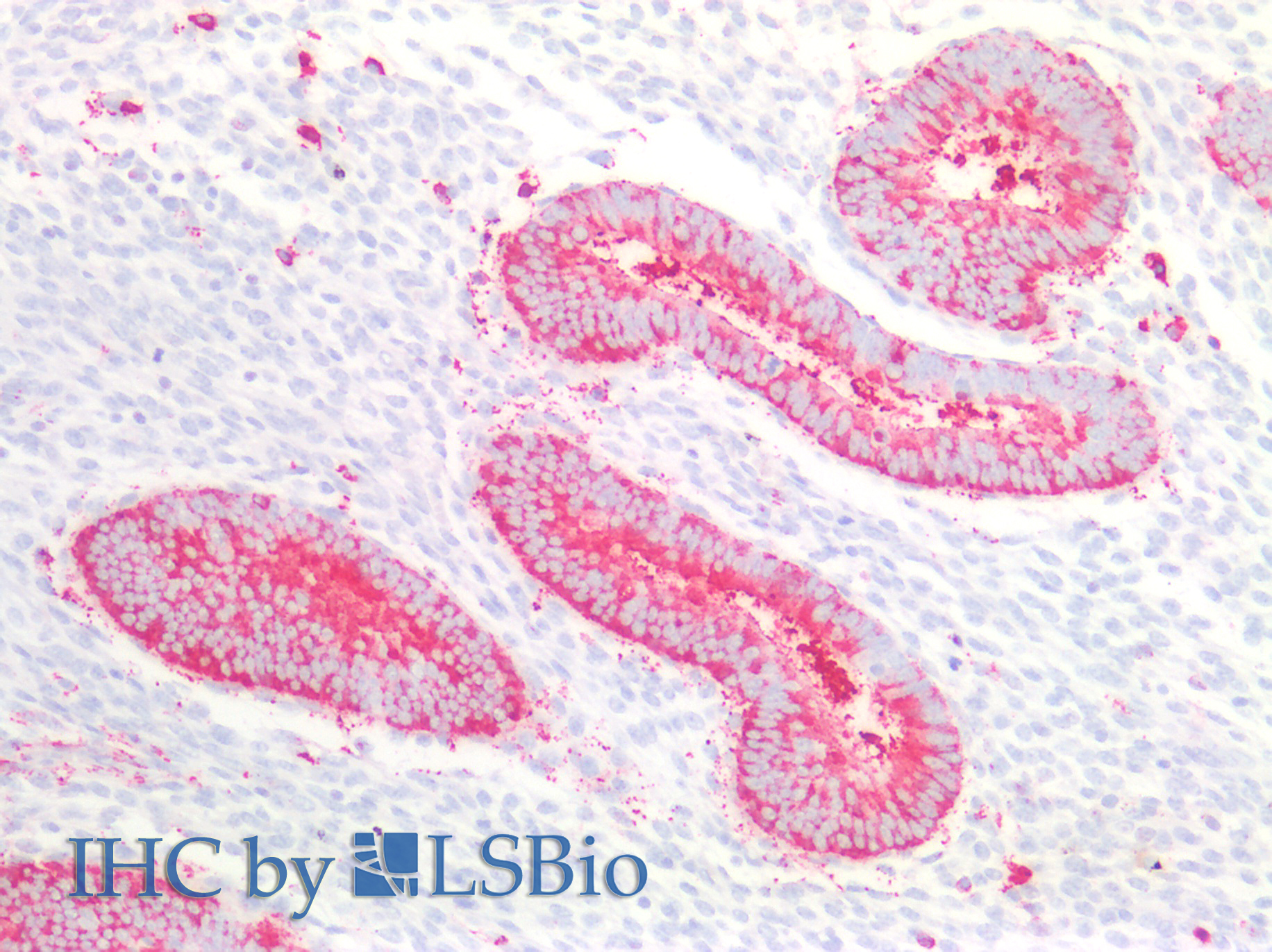 Polyclonal Antibody to RNA Exonuclease 2 Homolog (REXO2)