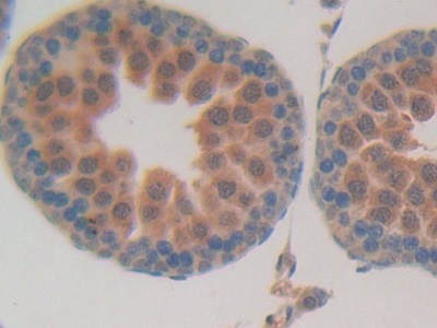 Polyclonal Antibody to R-Spondin 1 (RSPO1)