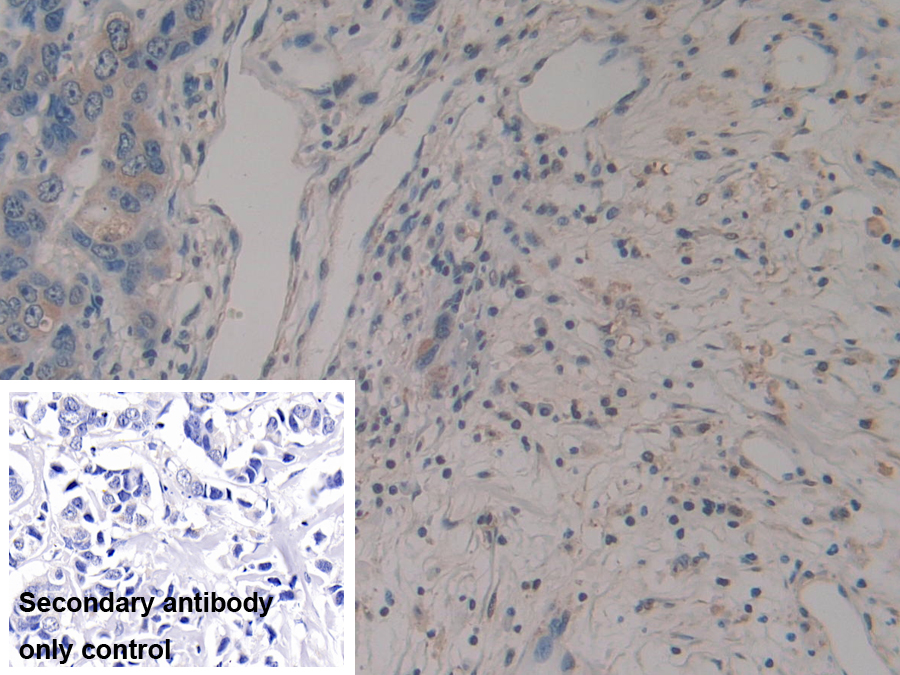 Polyclonal Antibody to R-Spondin 3 (RSPO3)