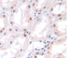 Polyclonal Antibody to Suppressor Of Ty 6 Homolog (SUPT6H)