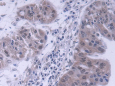 Polyclonal Antibody to Transcription Factor Dp1 (TFDP1)