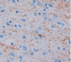 Polyclonal Antibody to Tomoregulin 1 (TR1)