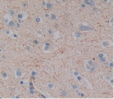 Polyclonal Antibody to Tomoregulin (TR)