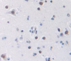 Polyclonal Antibody to Transformer 2 Beta (TRA2b)